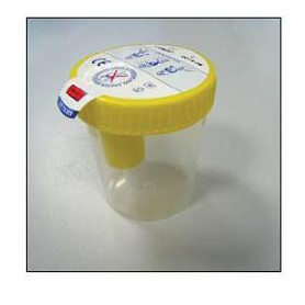 KIT CONTENITORE URINA SECUR BOX TAPPO GIALLO A VITE CON PUNTO DI PRELIEVO 120 ML 1 PEZZO