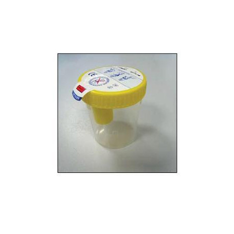 KIT CONTENITORE URINA SECUR BOX TAPPO GIALLO A VITE CON PUNTO DI PRELIEVO 120 ML 1 PEZZO